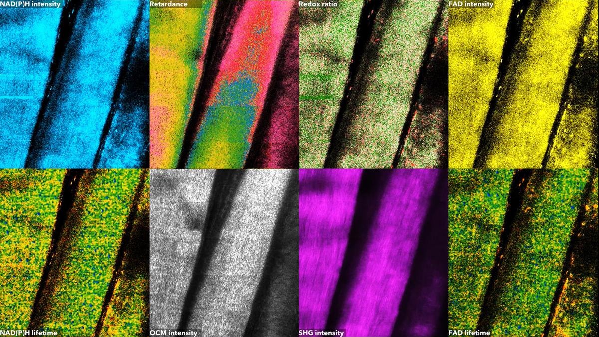 Biological Rhapsody: Is this the label-free microscopic life? Is this just an Andy Warhol piece? by Rishyashring Raman Iyer from Electrical and Computer Engineering